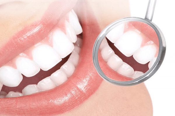 Răng sứ zirconia giá bao nhiêu? Bí quyết có hàm răng đẹp 8