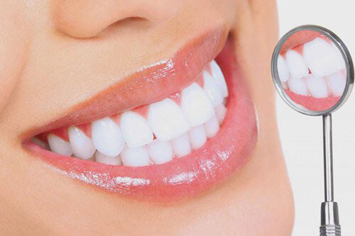 Răng sứ zirconia giá bao nhiêu? Bí quyết có hàm răng đẹp 6