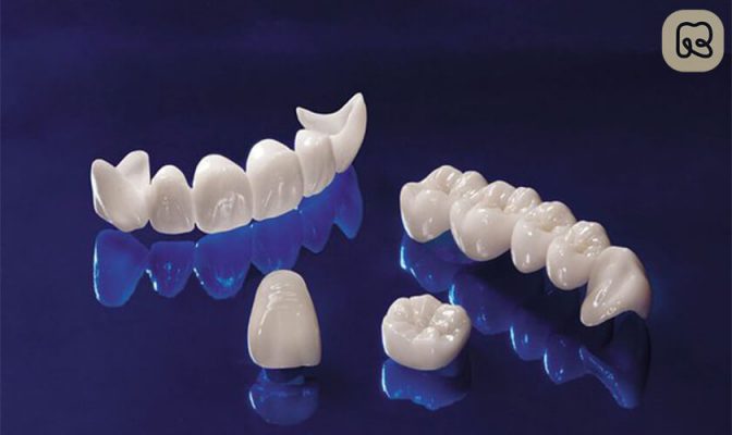 Răng sứ zirconia giá bao nhiêu? Bí quyết có hàm răng đẹp 5
