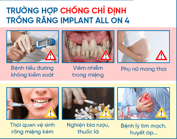 All On 4 Implants- Giải Pháp Cho Người Mất Răng Toàn Hàm 11