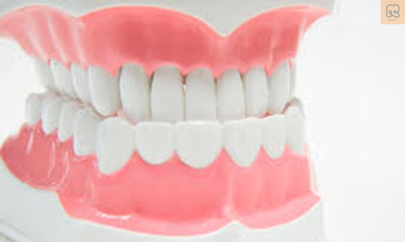 Móm răng là gì? Nguyên nhân, hậu quả và cách điều trị hiệu quả tốt nhất 6