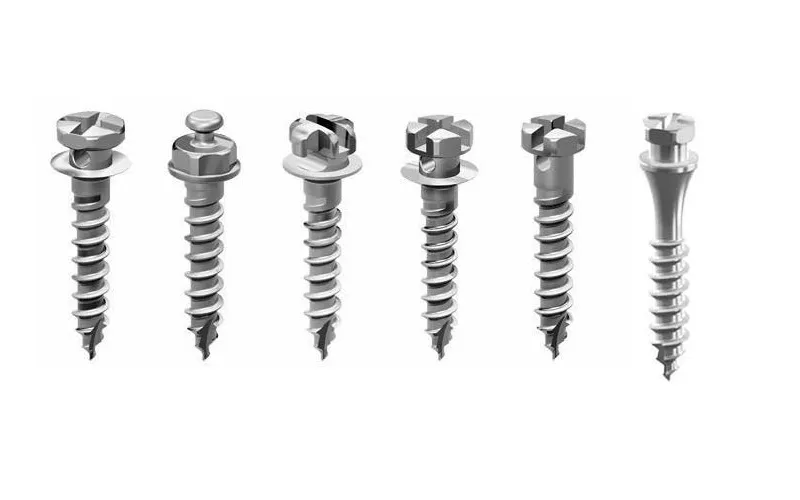 Bắt Vít Niềng Răng Có Đau Không? Giải Đáp Mọi Thắc Mắc Về Thời Gian & Hiệu Quả 9